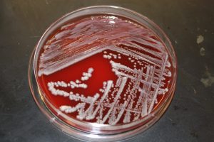 Cultivo de klebsiella oxytoca 